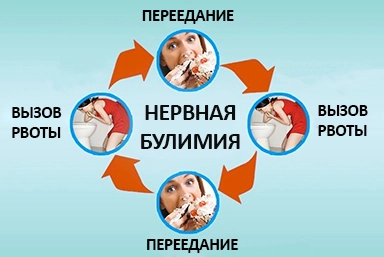 Лечение булимии в Новой Чаре